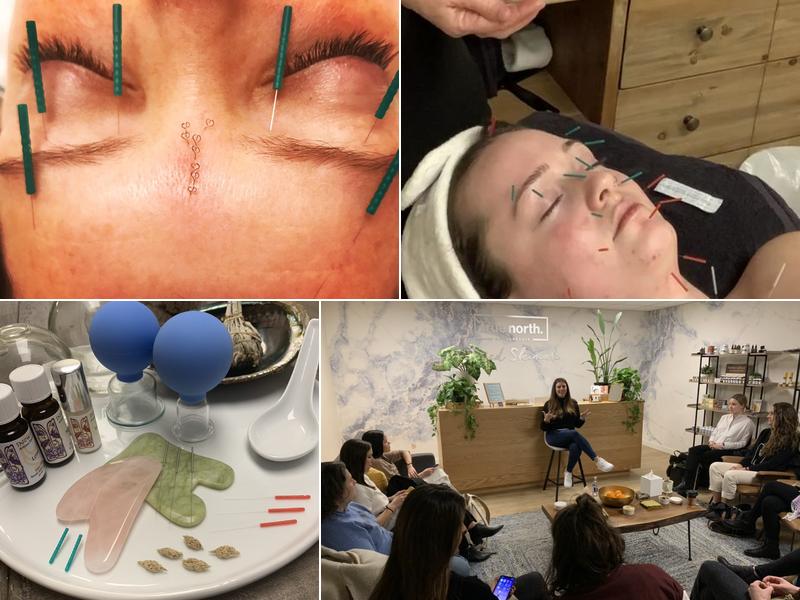 True North Acupuncture