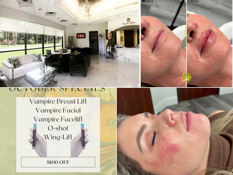 Chrysolite Aesthetics