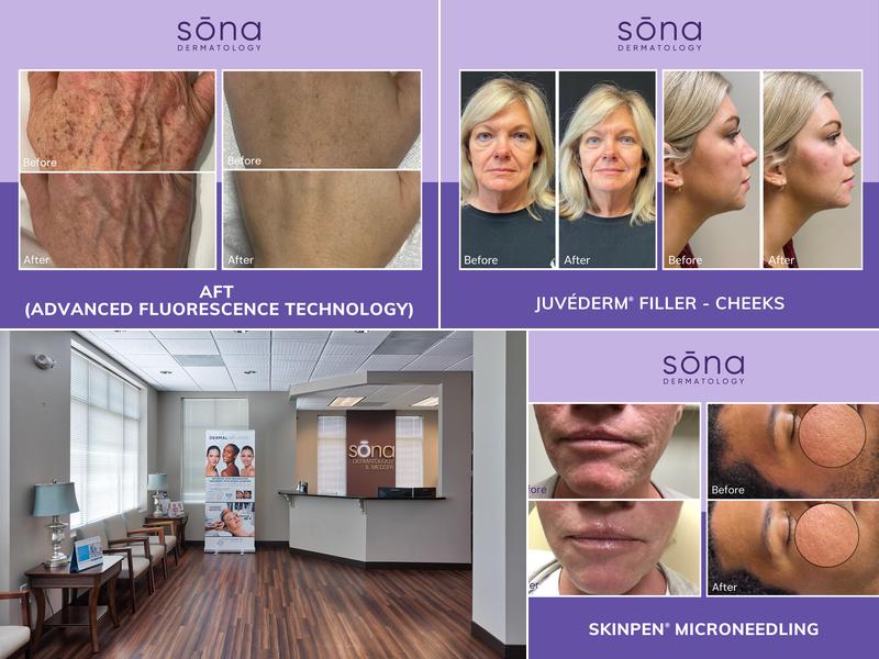 Sona Dermatology of Richmond