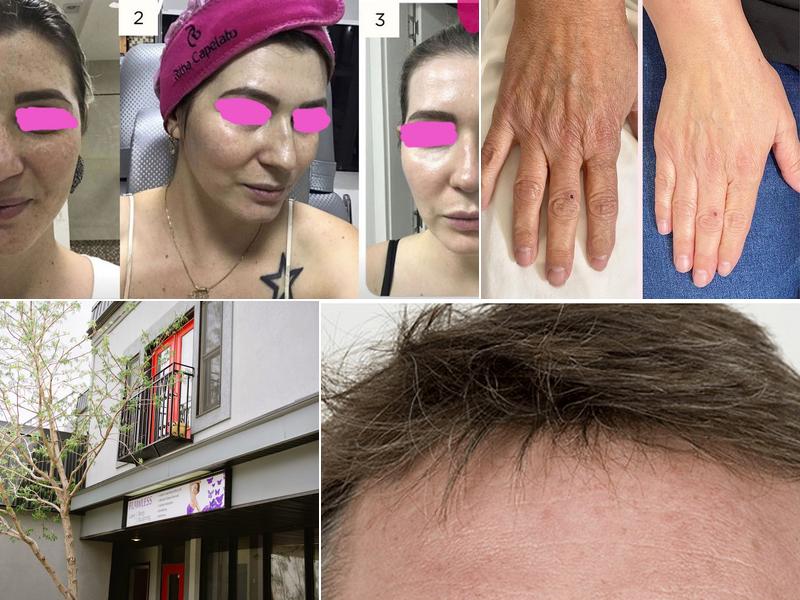 Flawless Laser & Body Sculpting