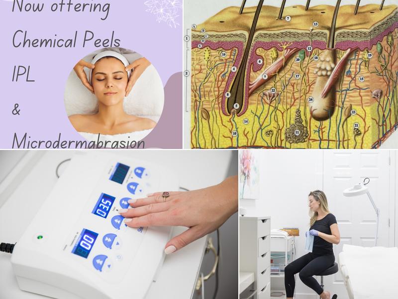 The Root Electrolysis