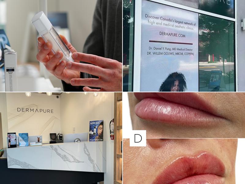 Dermapure Lower Lonsdale (formerly Dermal Laser)