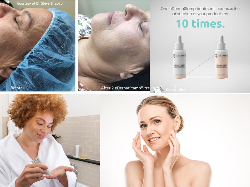 Spring Laser & Skin Care
