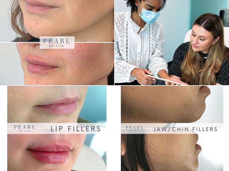 Pearl on King - Toronto Botox, Fillers & PRP