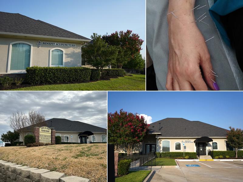 Benefit Acupuncture