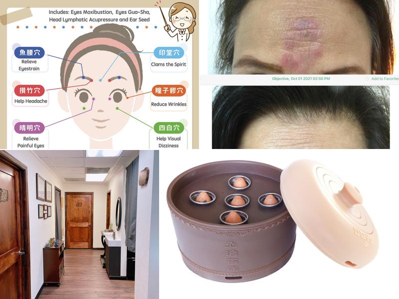 Mother Moon Acupuncture and Herb