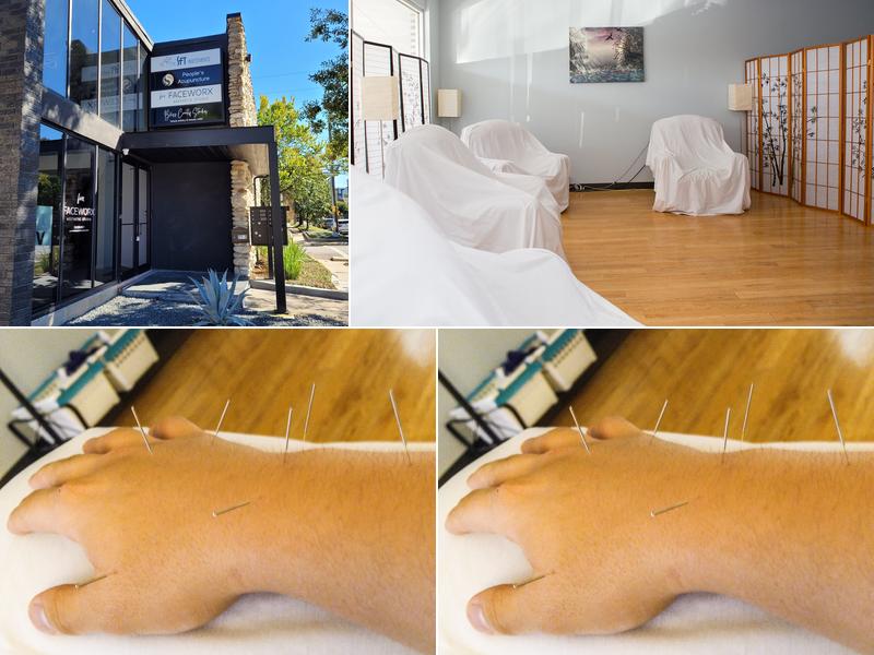 People's Acupuncture Tx