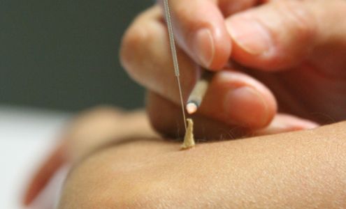 Bocangel Integrative Medicine & Acupuncture