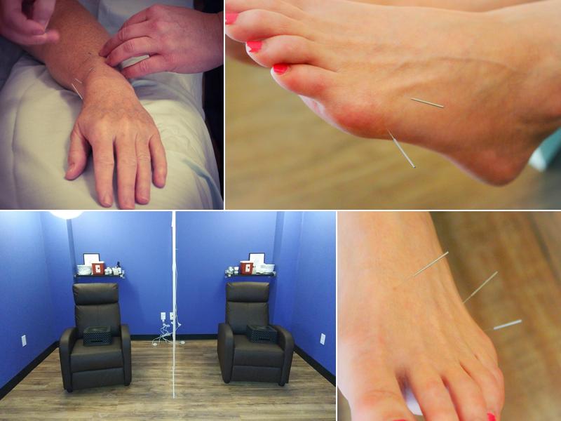 Comal Springs Acupuncture