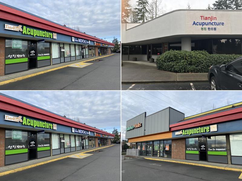 Tianjin Acupuncture