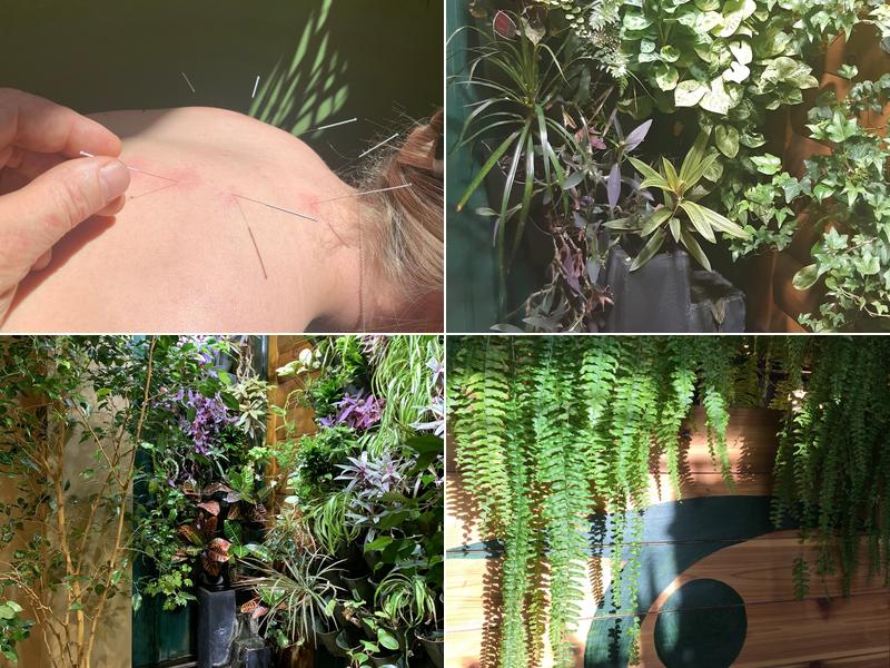 The Acupuncture Turning Point