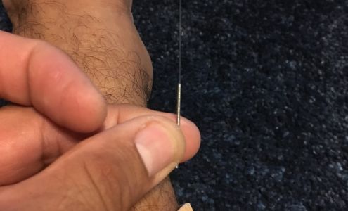 Chinese Medicine & Acupuncture Clinic