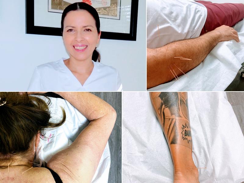 Acupuncture Nuvomed Montreal