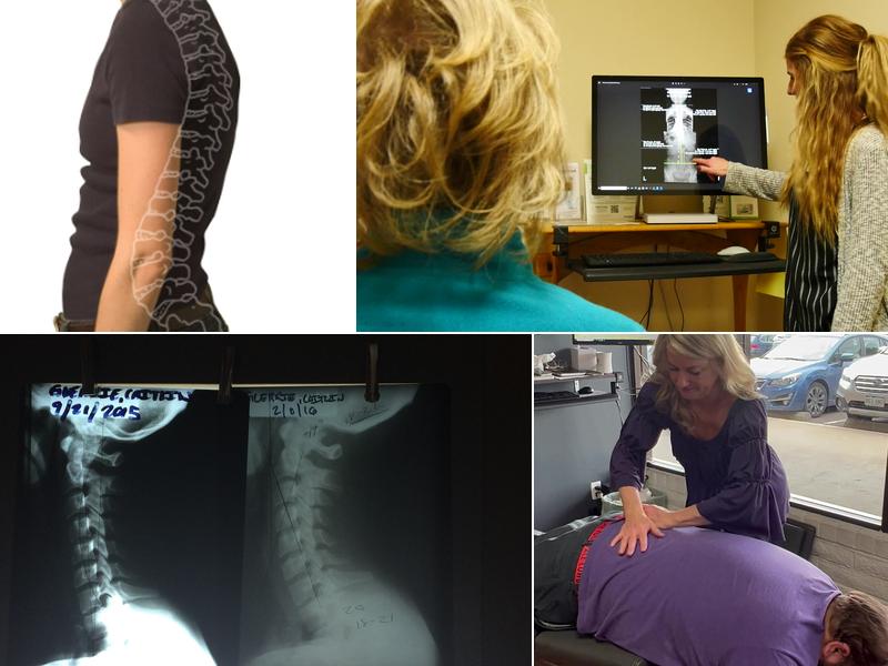 Terry Chiropractic Boulder