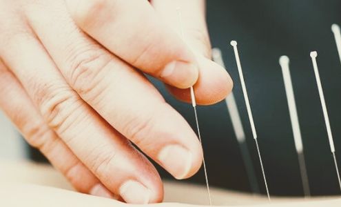 SDR Healing Acupuncture SDR針灸診所 SDR한의원 SDR鍼灸院