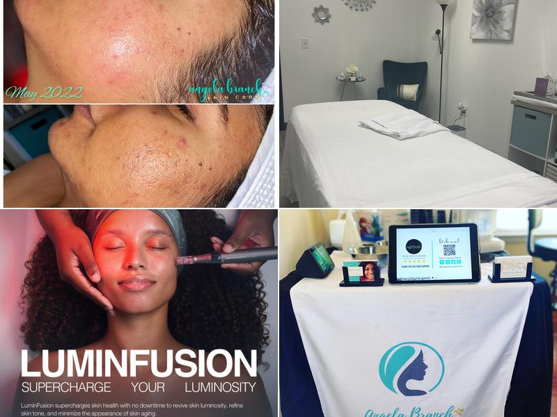 Angela Branch Skin Care