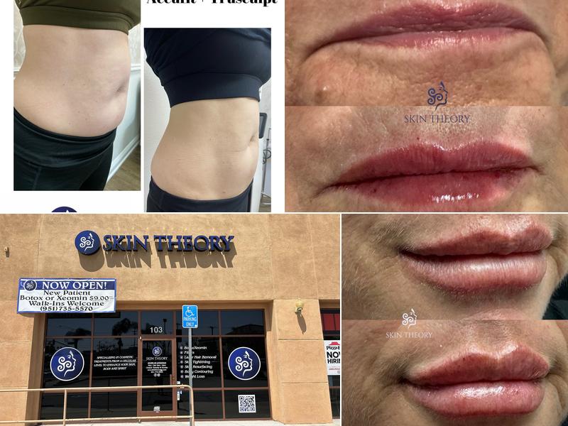 Skin Theory Aesthetics Med Spa Riverside