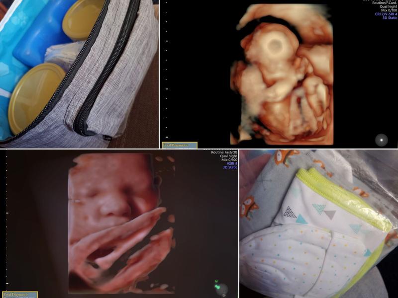 Greggory Devore Fetal Diagnostic