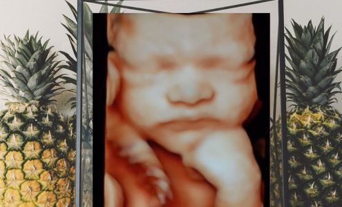 4D Treasured Memories Sonograms