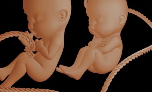 UC Baby 3D Ultrasound