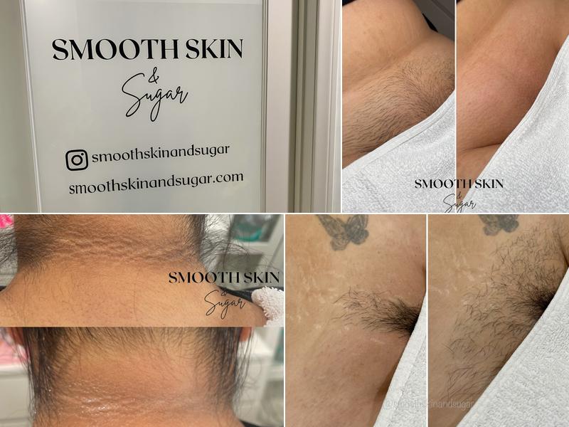 Smooth Skin and Sugar