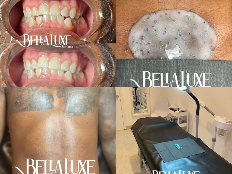 Bella Luxe Aesthetics