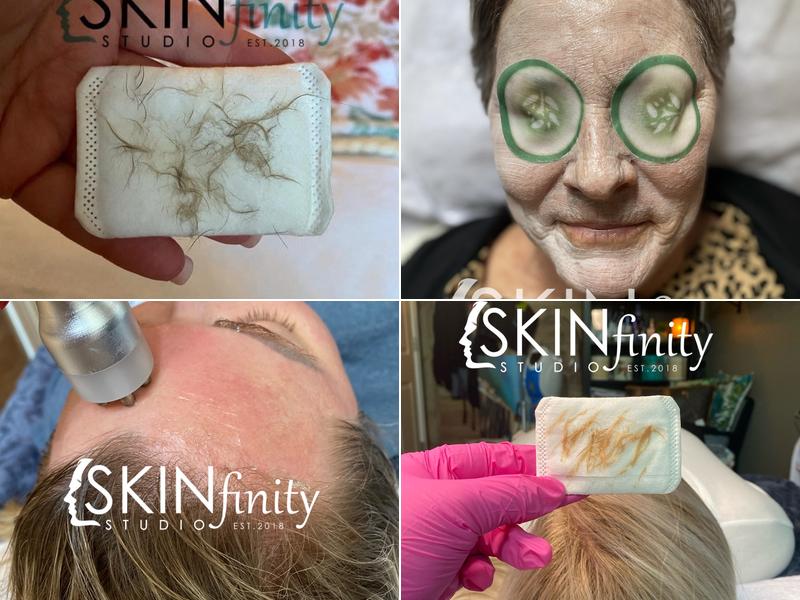 SKINfinity Studio