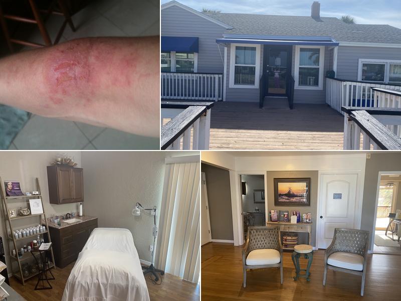 Fit for Life Acupuncture