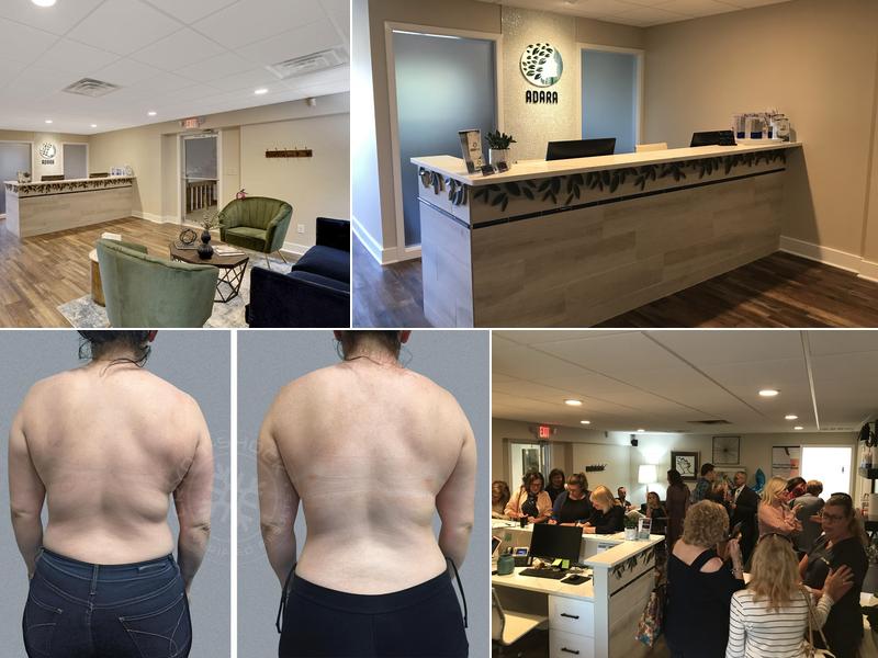 Adara Body Sculpting & Anti Aging Center