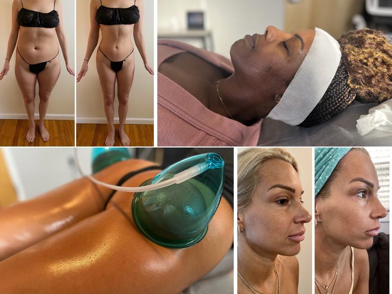 Transformare Bellezza