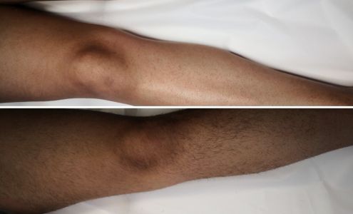 Marina's sugaring center