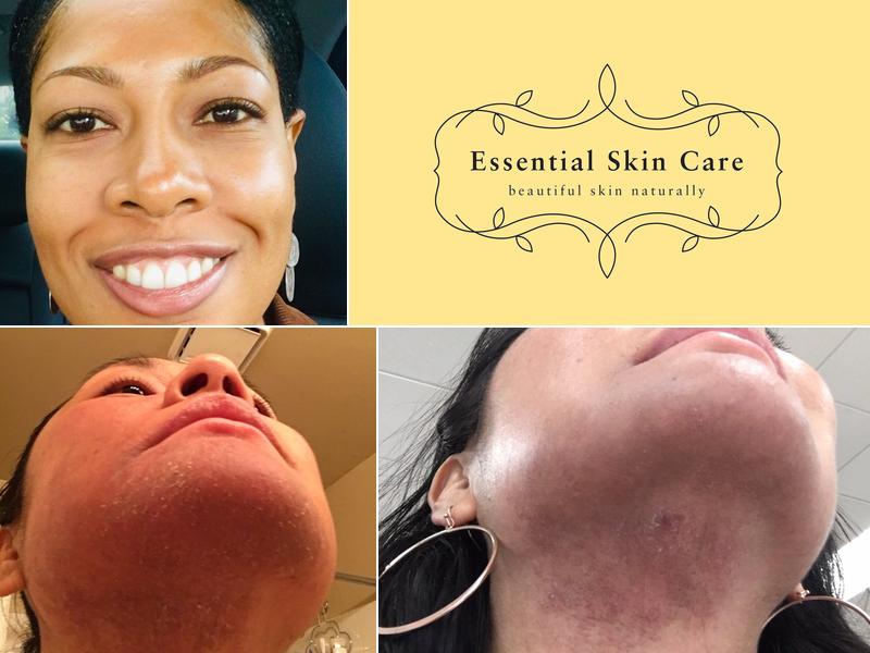 Essential Skincare and Electrolysis