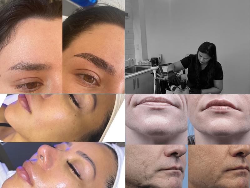 Best Brow Spa and Laser - HydraFacial MD