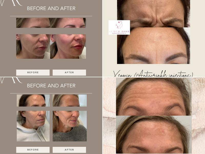 Aurum Rose Aesthetics and Wellness