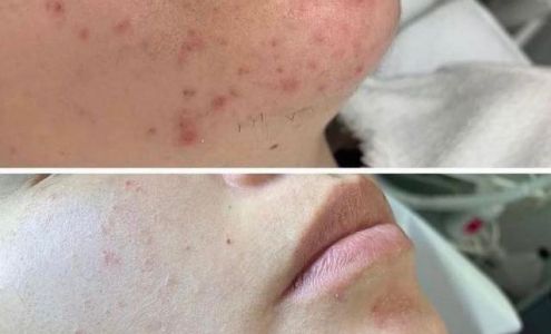 Aura Relaxation Spa 2 Starigan Hill Rd, St. Anthony Newfoundland and Labrador A0K 4T0