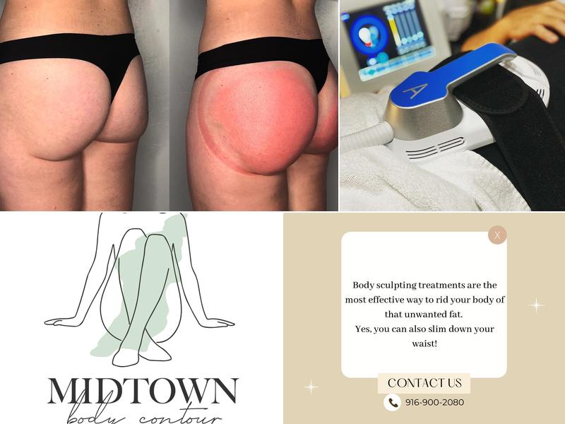 Midtown Body Contour