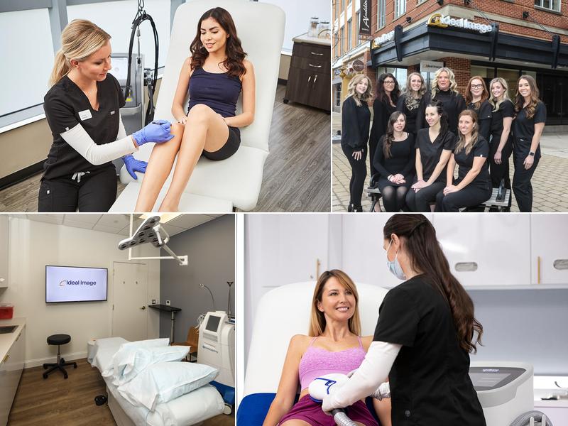 Ideal Image Westlake - Crocker Park