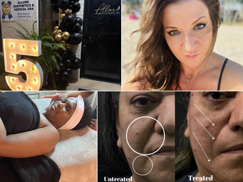 Allure Aesthetics & Medical Spa