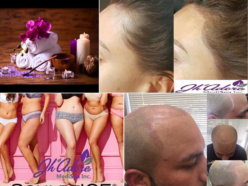 Jh'Adore MediSpa