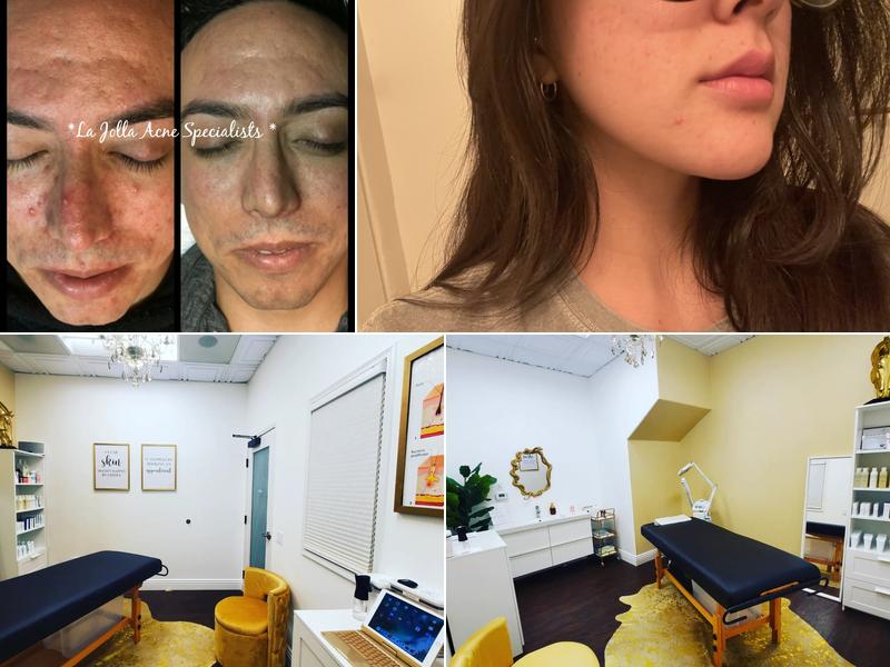 La Jolla Acne Specialists