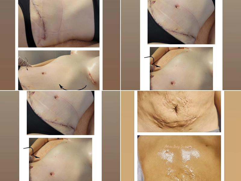 ️ Allure Body Sculpting