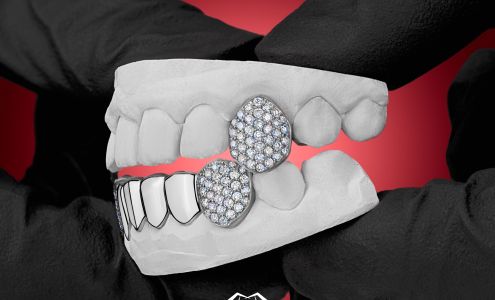 GotGrillz - Custom Gold Grillz Made in Houston [Custom Grillz For Teeth]