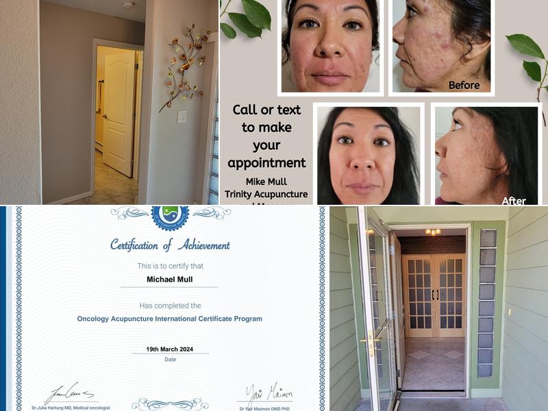 Trinity Mobile Massage and Acupuncture