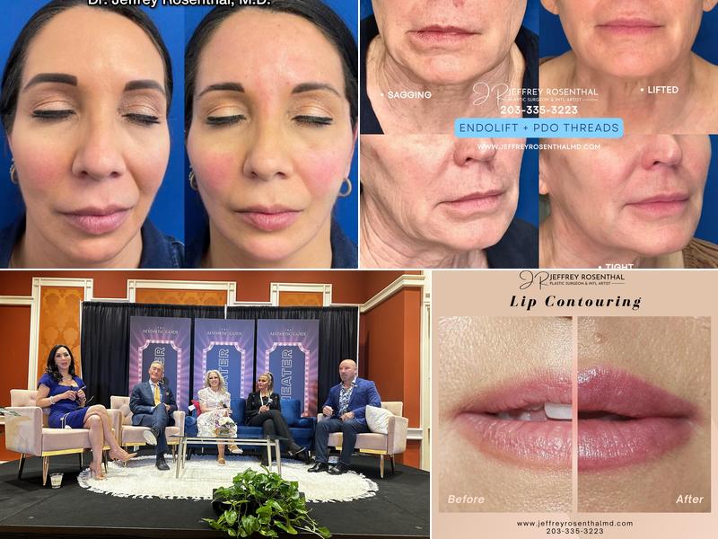 Jeffrey Rosenthal, M.D.