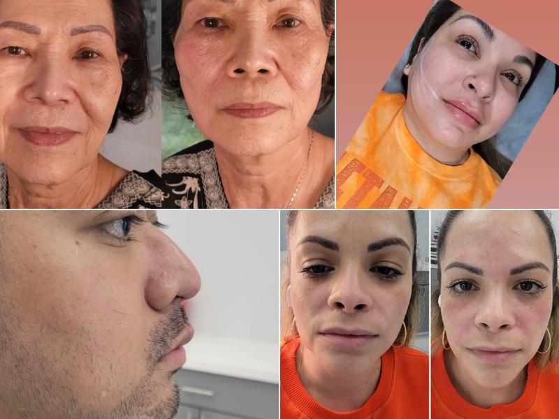 Injection Bar Medspa & Wellness