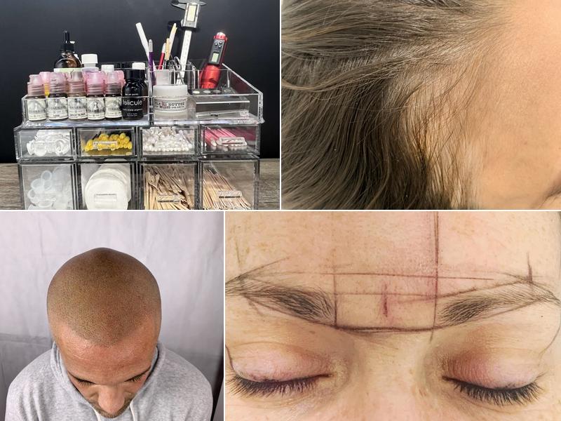 Dermesthetica Scalp Micropigmentation and Combo Eyebrows