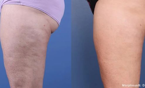 Acacia Medical Spa of Yuma