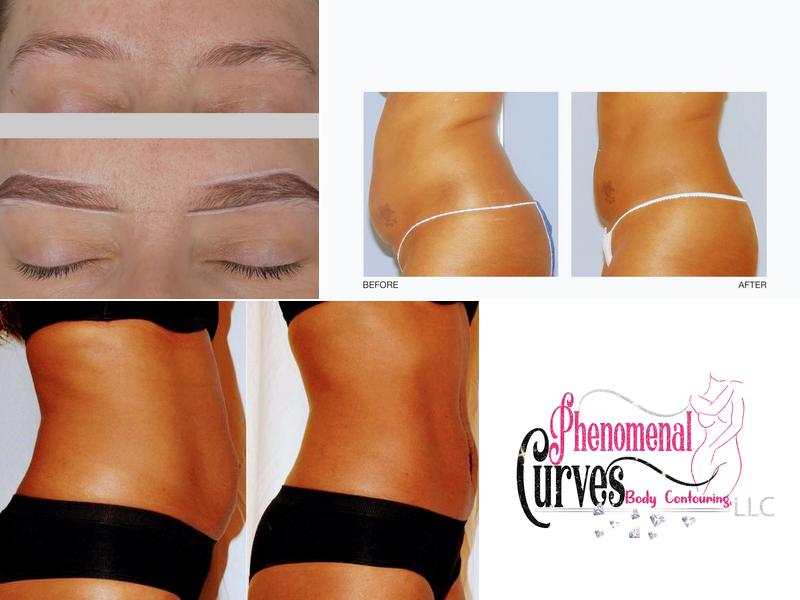 Phenomenal Curves Body Contouring, LLC