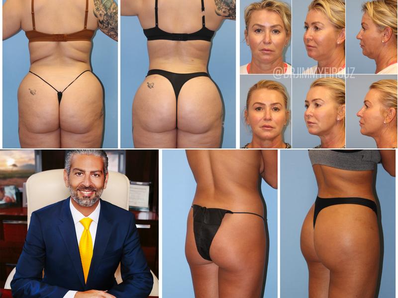 Jimmy S. Firouz, MD, FACS