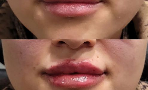 Olack Plastic & Reconstructive Surgery